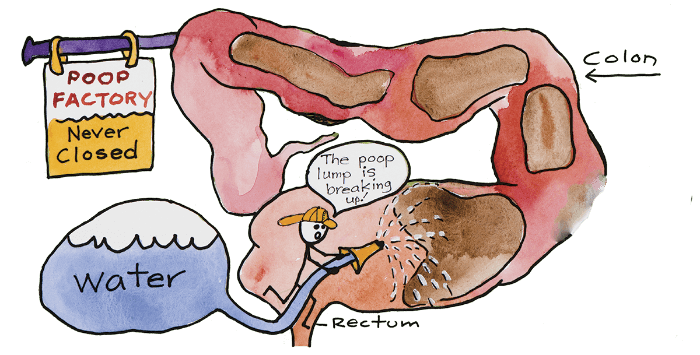 What to Eat After a Colonic Hydrotherapy Session? 3 Colonic Hydrotherapy
