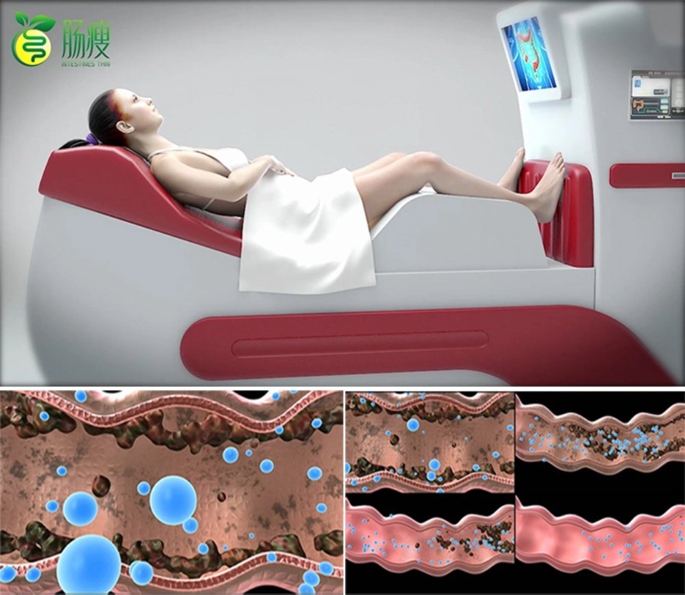 Colon Hydrotherapy in Naples: Expert Insights & Top Recommendations 4 Colon Hydrotherapy in Naples