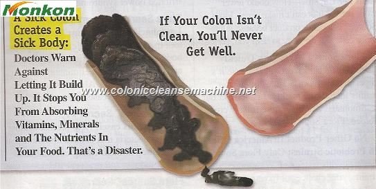 What to Eat After Colon Hydrotherapy