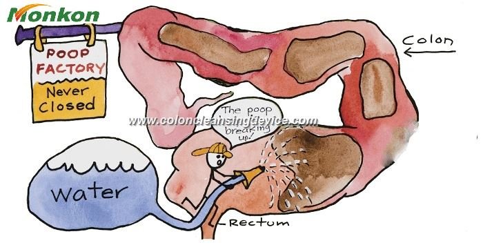Colon Hydrotherapy Diet