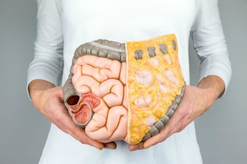 Colon Hydrotherapy Diet