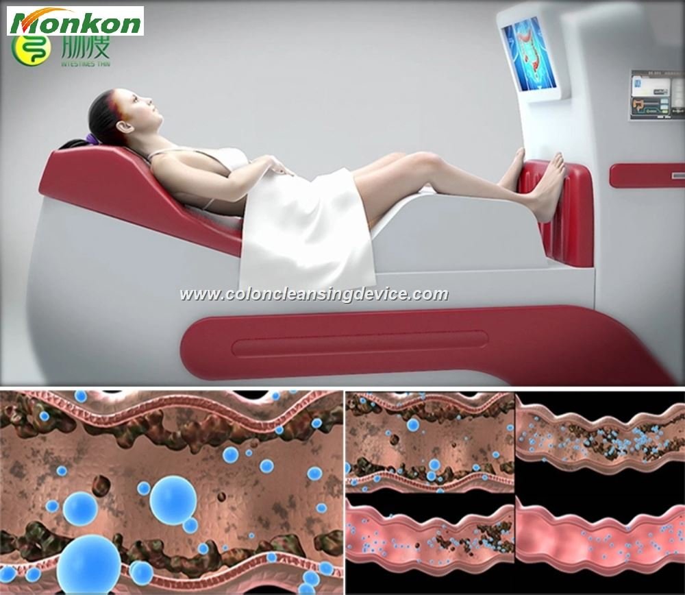 Colon Hydrotherapy Open System: Benefits, How It Works & Expert Guide | MAIKONG 13 Colon Hydrotherapy Open System 256