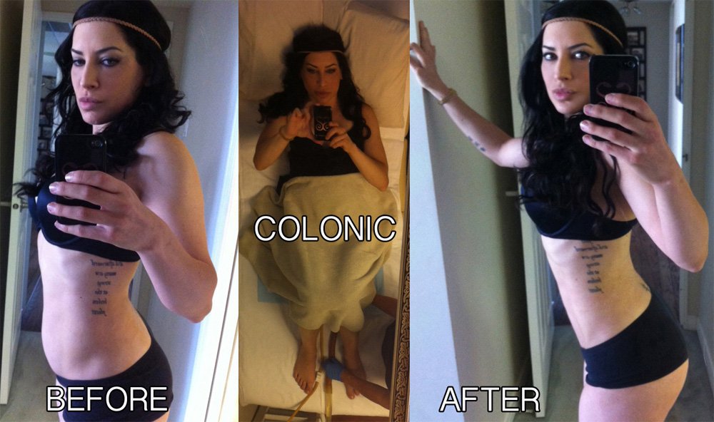 How Much Does Colonic Hydrotherapy Cost