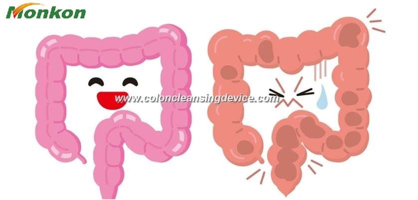 Open System Colon Hydrotherapy 290