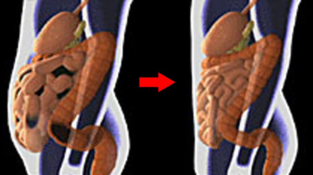 Open System Colon Hydrotherapy 428