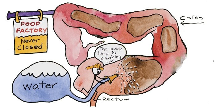 Open System Colon Hydrotherapy 446