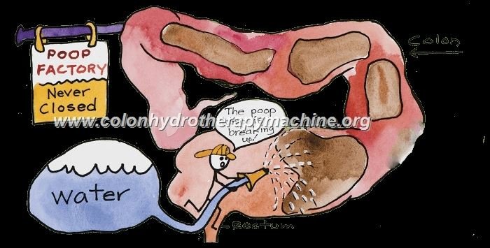 Open vs Closed Colon Hydrotherapy: Expert Guide to Choosing the Safest & Most Effective System